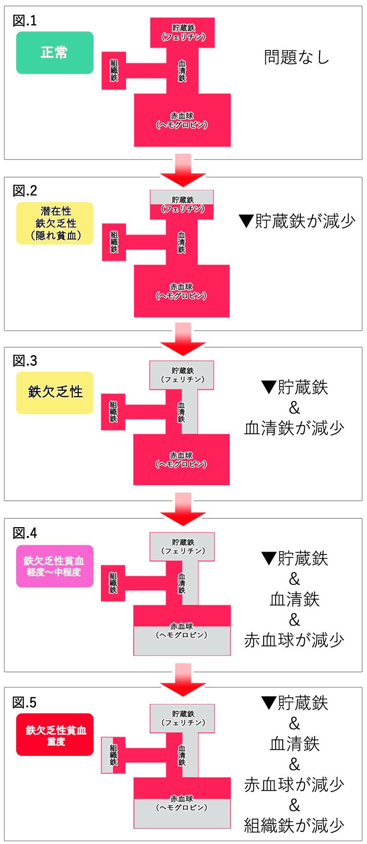 
「血液検査で確認される貧血の進行段階を4つに分けて示したフロー図。鉄分不足の初期から、軽度・中等度・重度の貧血へと進行し、ヘモグロビン低下や酸素供給障害、臓器への影響などが段階的に現れることを視覚化している