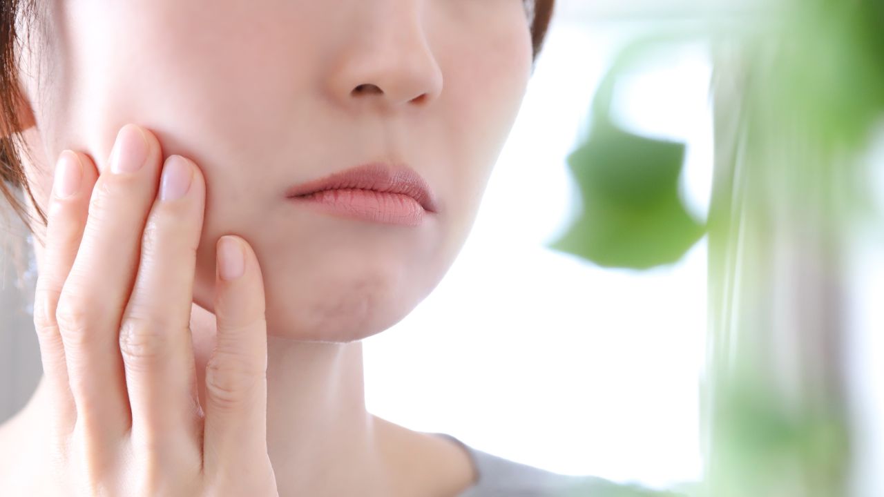 肌荒れに悩み頬をおさえる女性。貧血による鉄分不足が肌トラブルの原因になっている可能性を示唆