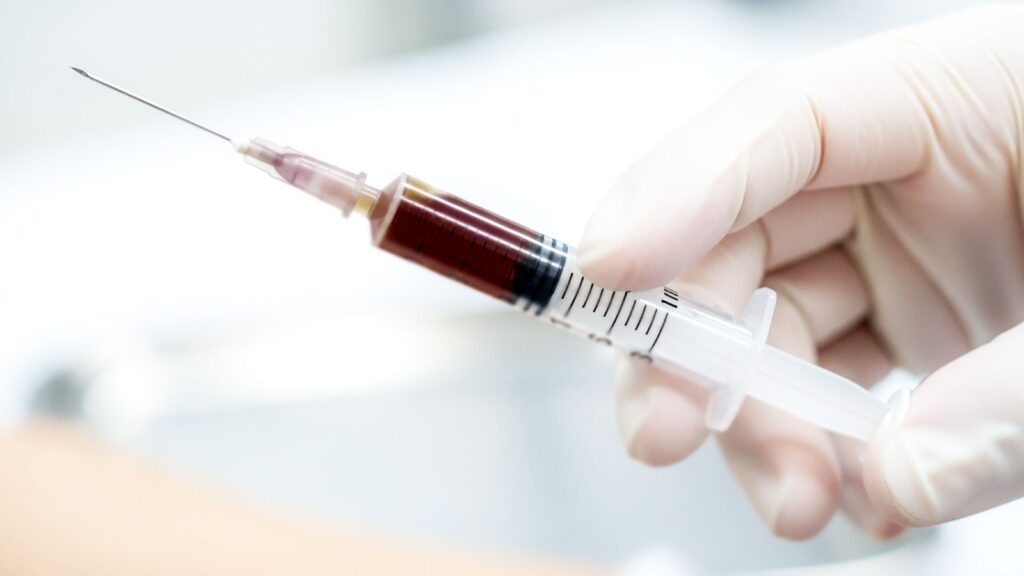 安易な鉄剤注射による鉄過剰症のリスクと、専門医による適切な血液検査と指導の重要性を伝える注意喚起の図。